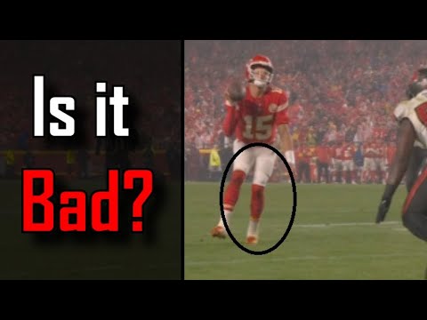 What we know about the Patrick Mahomes Injury | Kansas City Chiefs Vs Tampa Bay Buccaneers