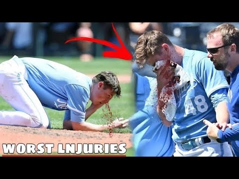 MLB | Awful lnjuries• Part 6